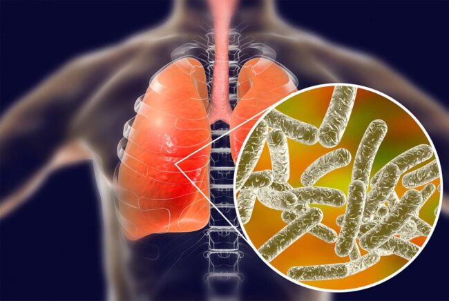 Legionella Control Services