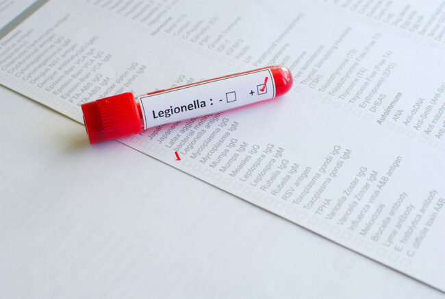 legionella risk management