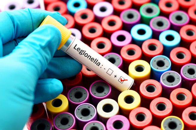 understanding legionella